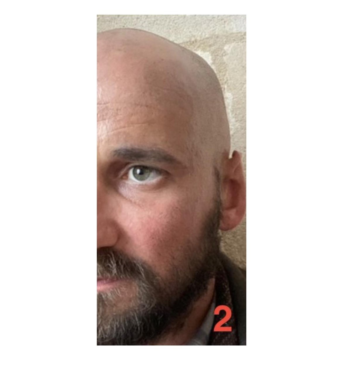 Relance -- Doublure 2 - Homme 25/40 ans 